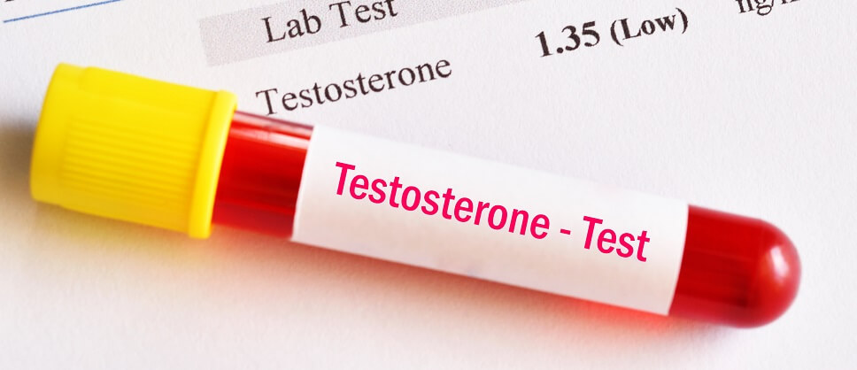 Normal Testosterone Levels By Age Manual