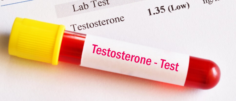 normal-testosterone-levels-by-age-manual