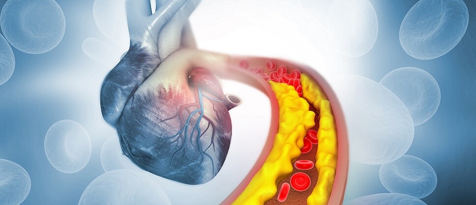 Vitamins to Lower Cholesterol | Manual