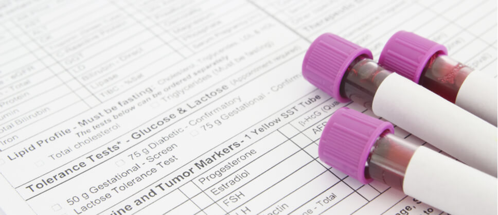 How Long Do Psa Blood Test Results Take