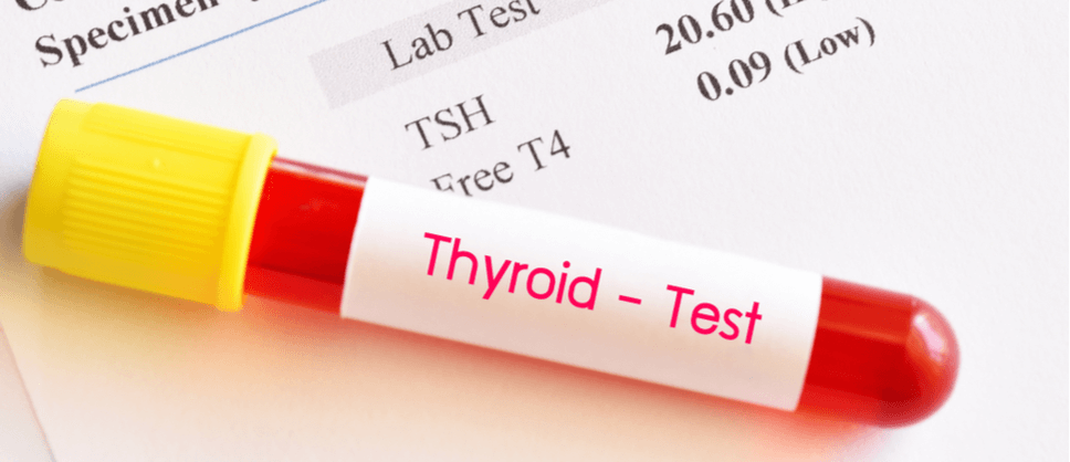 Can You Eat Before Tsh Blood Test